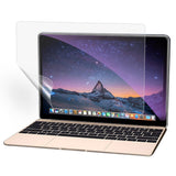 Macbook Pro 15 Retina PET Protective Film - Transparent